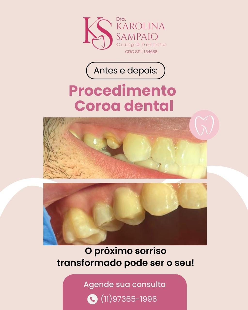 Resultado 4